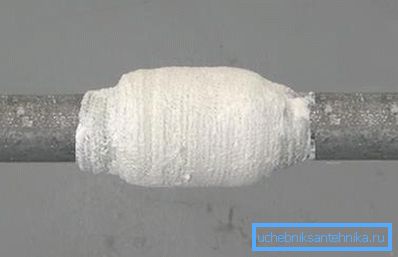 Bir kumaş lastiği, bir fistülün kapatılması için en güvenilir yöntemlerden biridir. Bir kumaş lastiği, bir fistülün kapatılması için en güvenilir yöntemlerden biridir.